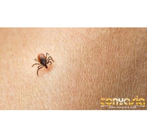 Seorang Bocah Mengalami Penyakit Virus Lyme, Termyata Kutu Penyebabnya | Agen Poker Online | Poker Online 